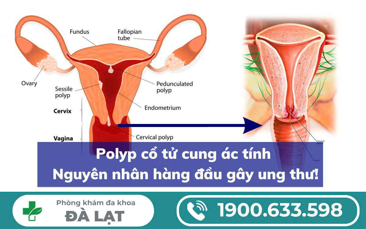 Hình ảnh minh họa